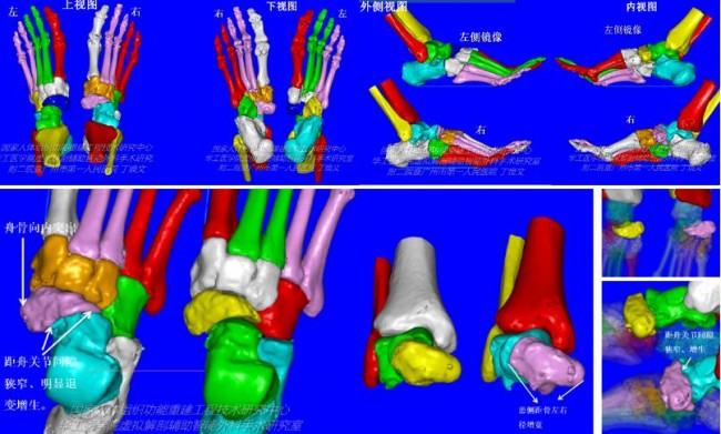 3D打印