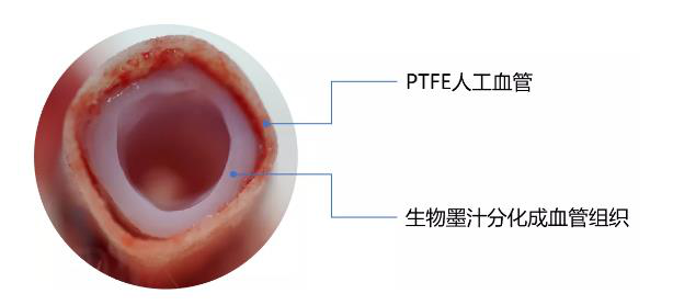 3D打印血管