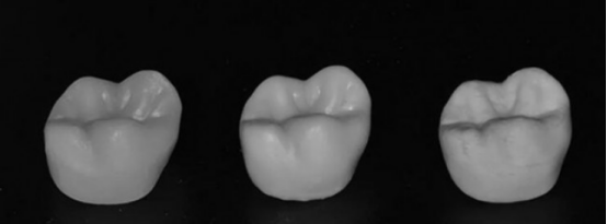 3D打印牙冠