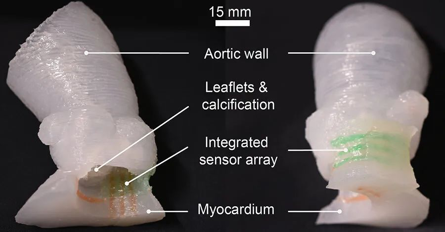 3D打印心脏瓣膜