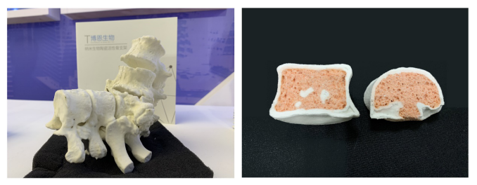 3D打印人造骨