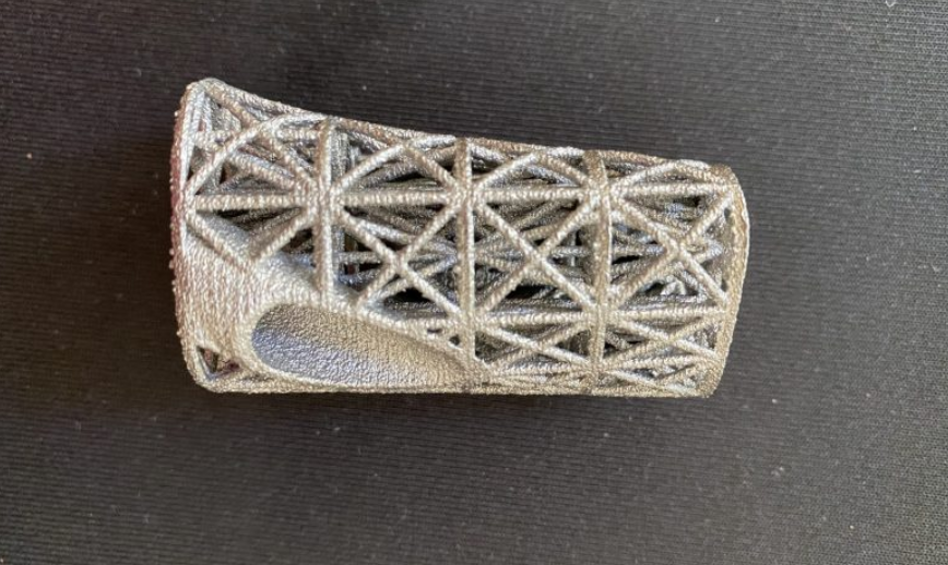  3D打印的胫骨
