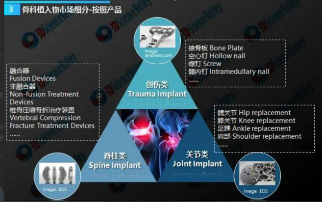 骨科植入物市场细分
