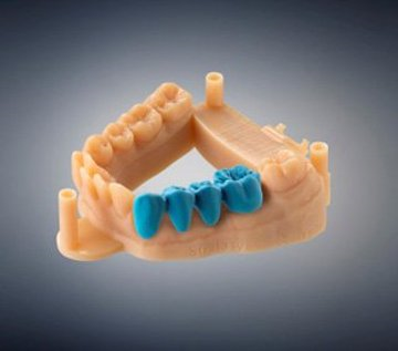 3D打印牙冠