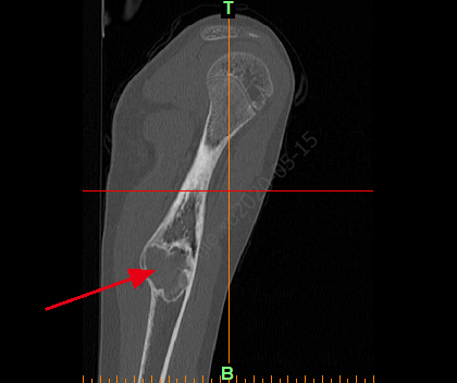 医学CT